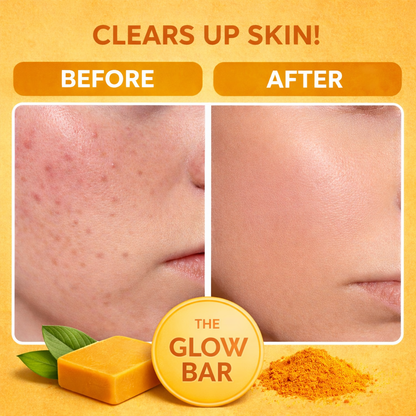 Turmeric Glow Cleansing Bar