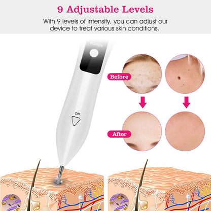 2 PCS Skin Tag Repair Kit