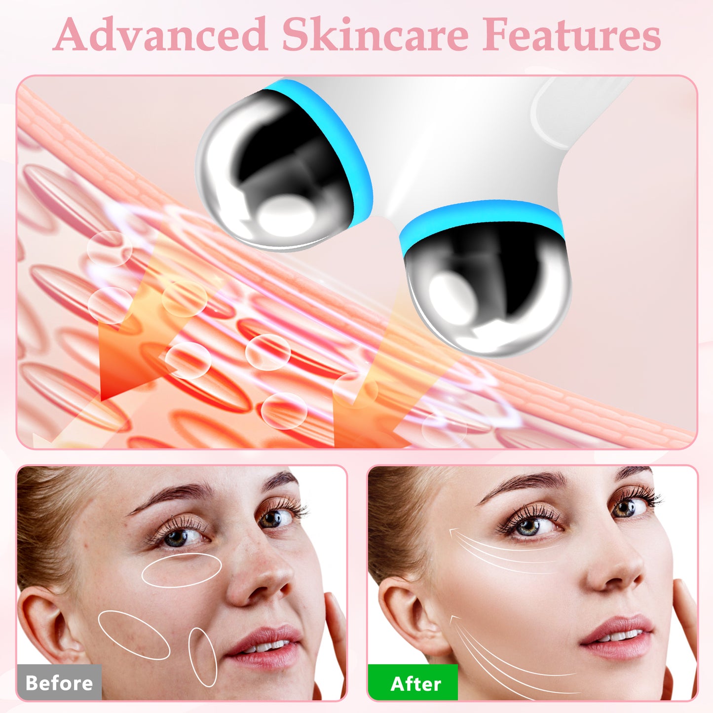 Anti Aging And Wrinkles Facial Device