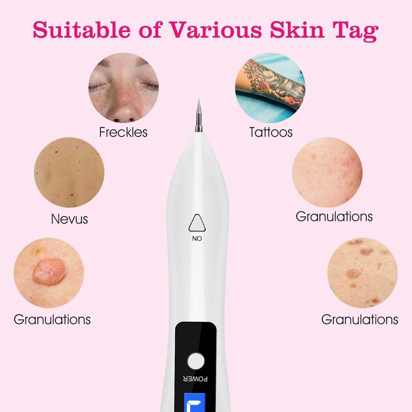 2 PCS Skin Tag Repair Kit